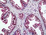 BRG1 Antibody in Immunohistochemistry (Paraffin) (IHC (P))