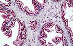 BRG1 Antibody in Immunohistochemistry (Paraffin) (IHC (P))