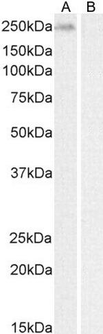 BRG1 Antibody in Western Blot (WB)