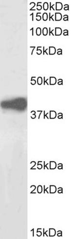 ADH1A/ADH1B/ADH1C Antibody in Western Blot (WB)