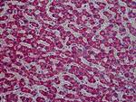 HYAL2 Antibody in Immunohistochemistry (Paraffin) (IHC (P))