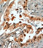 SRD5A1 Antibody in Immunohistochemistry (Paraffin) (IHC (P))