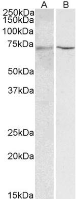 HNF1A Antibody in Western Blot (WB)