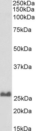 SNAP25 Antibody in Western Blot (WB)