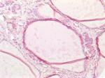 Cathepsin B Antibody in Immunohistochemistry (Paraffin) (IHC (P))