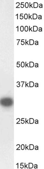 CTDSP1 Antibody in Western Blot (WB)