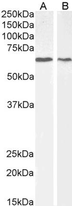 AKT1 Antibody in Western Blot (WB)