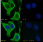 SHH Antibody in Immunocytochemistry (ICC/IF)