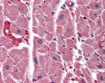 IP3 Receptor 2 Antibody in Immunohistochemistry (Paraffin) (IHC (P))