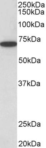 HDAC1 Antibody in Western Blot (WB)