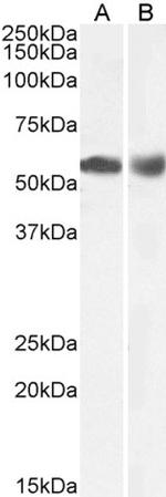 HDAC1 Antibody in Western Blot (WB)