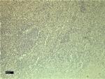 CXCR3 Antibody in Immunohistochemistry (Paraffin) (IHC (P))