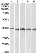 Aurora B Antibody in Western Blot (WB)