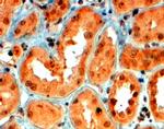 SEMA5A Antibody in Immunohistochemistry (Paraffin) (IHC (P))