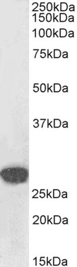 SNAIL Antibody in Western Blot (WB)