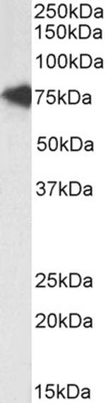 TCF3 Antibody in Western Blot (WB)