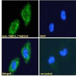 TMP21 Antibody in Immunocytochemistry (ICC/IF)