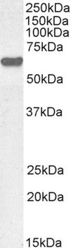 AKT1 Antibody in Western Blot (WB)