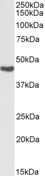 ASS1 Antibody in Western Blot (WB)