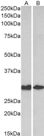 Galectin 3 Antibody in Western Blot (WB)