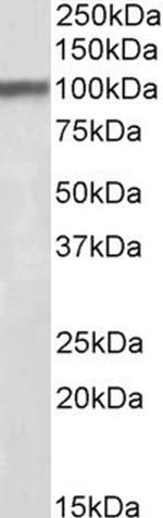 HAP1 Antibody in Western Blot (WB)