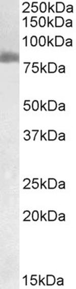 TGM2 Antibody in Western Blot (WB)