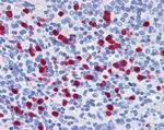 GCC2 Antibody in Immunohistochemistry (Paraffin) (IHC (P))