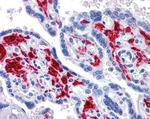 RIG-I Antibody in Immunohistochemistry (Paraffin) (IHC (P))