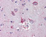 Nodal Antibody in Immunohistochemistry (Paraffin) (IHC (P))