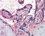 Nodal Antibody in Immunohistochemistry (Paraffin) (IHC (P))