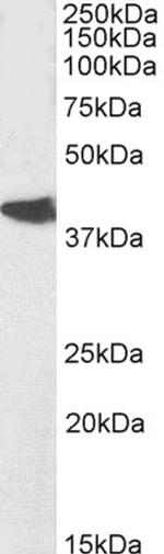 Nodal Antibody in Western Blot (WB)