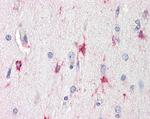 BAG3 Antibody in Immunohistochemistry (Paraffin) (IHC (P))