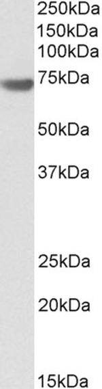 BAG3 Antibody in Western Blot (WB)