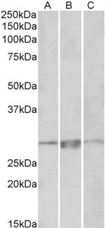 PRRX1 Antibody in Western Blot (WB)