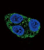 Tyrosinase Antibody in Immunocytochemistry (ICC/IF)