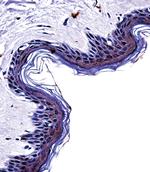 Tyrosinase Antibody in Immunohistochemistry (Paraffin) (IHC (P))