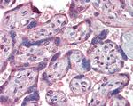 IFNAR2 Antibody in Immunohistochemistry (Paraffin) (IHC (P))