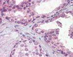 IFNAR2 Antibody in Immunohistochemistry (Paraffin) (IHC (P))