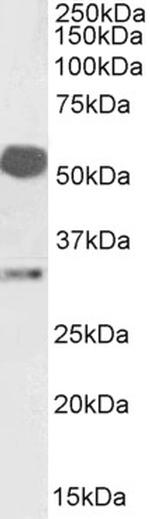 Estrogen Receptor beta Antibody in Western Blot (WB)