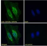 CEP290 Antibody in Immunocytochemistry (ICC/IF)