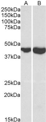 GOT2 Antibody in Western Blot (WB)