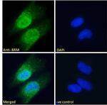 SMARCA2 Antibody in Immunocytochemistry (ICC/IF)