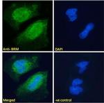 SMARCA2 Antibody in Immunocytochemistry (ICC/IF)