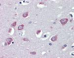 TRPC1 Antibody in Immunohistochemistry (Paraffin) (IHC (P))