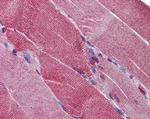 PCSK6 Antibody in Immunohistochemistry (Paraffin) (IHC (P))