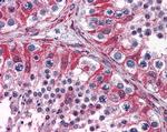 PCSK6 Antibody in Immunohistochemistry (Paraffin) (IHC (P))