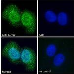 AUTS2 Antibody in Immunocytochemistry (ICC/IF)