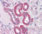 PARP3 Antibody in Immunohistochemistry (Paraffin) (IHC (P))