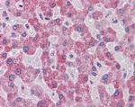 PARP3 Antibody in Immunohistochemistry (Paraffin) (IHC (P))