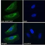 AGXT Antibody in Immunocytochemistry (ICC/IF)